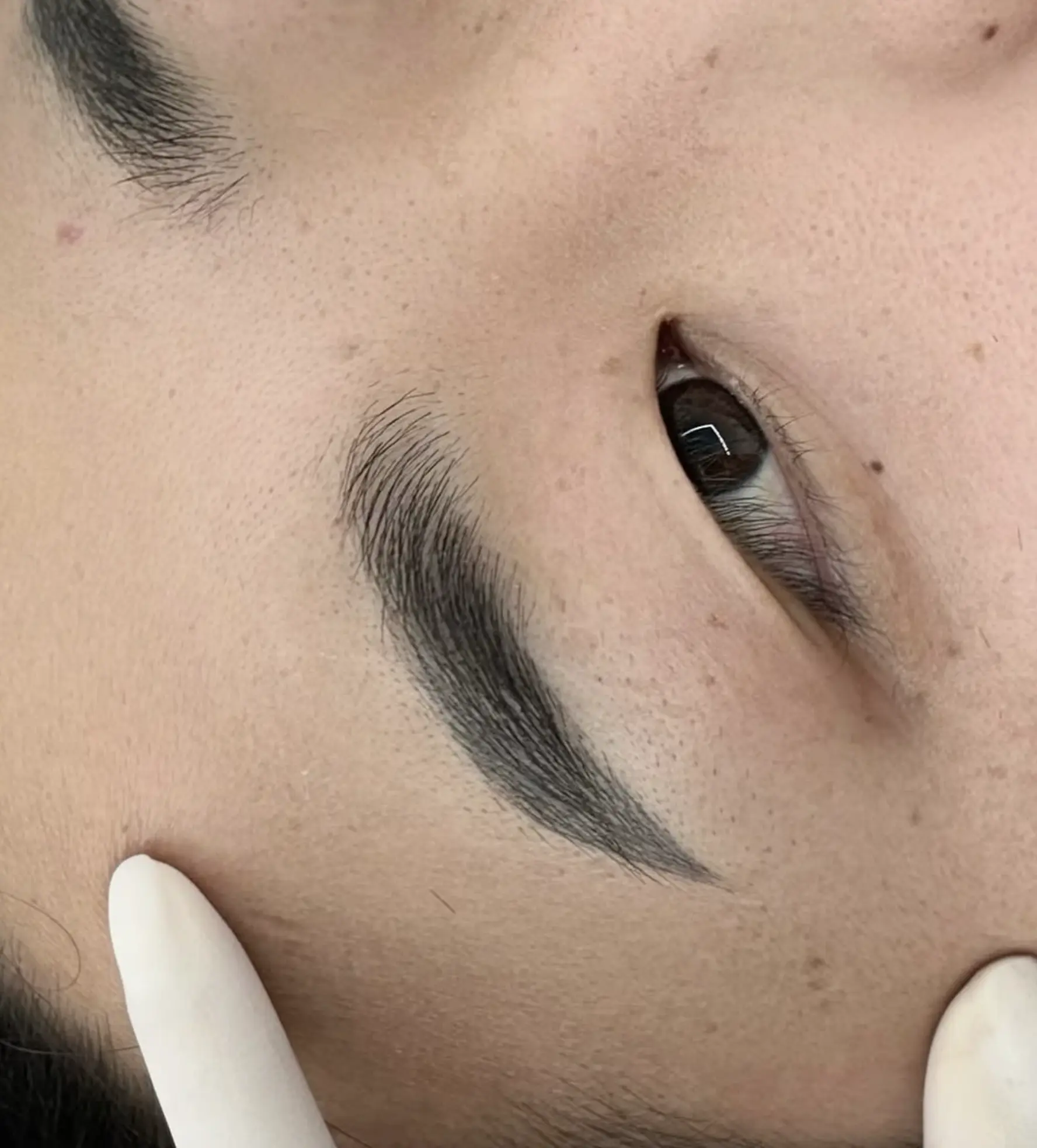 Before and after eyebrow tattoo removal